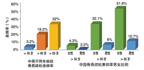 女性骨质情况